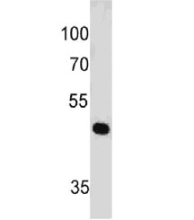 PAX7 Antibody (clone PAX7/497)