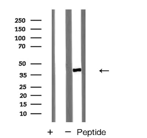 Polyclonal Rabbit anti-Human CHEMR23 / CMKLR1 Antibody (IF, WB)