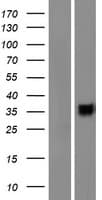 CD200R1L Protein (Over-Expression Lysate Myc-DDK (Flag))