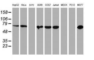 PDIA4 / ERP72 Antibody (clone OTI2B11)
