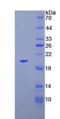 Human SLC12A3 / TSC Protein (Recombinant His)