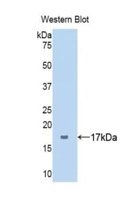 SERPING1 / C1 Inhibitor Antibody (aa399-500, clone C2)