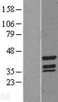 TINF2 Protein (Over-Expression Lysate Myc-DDK (Flag))