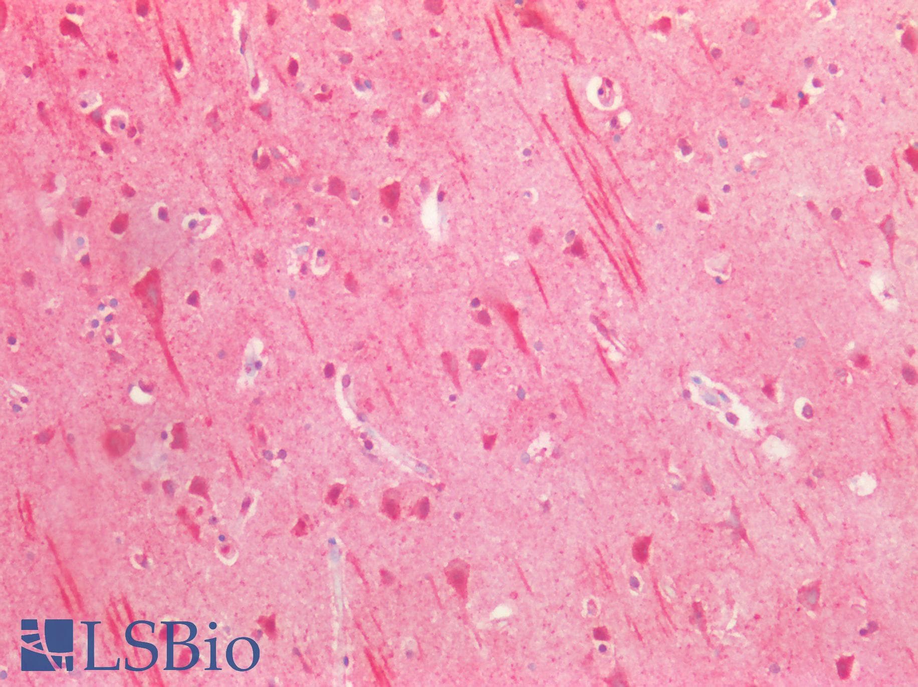 PathPlus™ Polyclonal Rabbit anti-Human BECN1 / Beclin-1 Antibody (N-Terminus, IHC, WB)