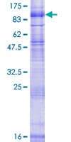 Human SV2B Protein (Recombinant GST)