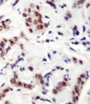 STAT5A Antibody (phospho-Tyr694)