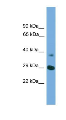 ATG16L1 / ATG16L Antibody (aa121-170)