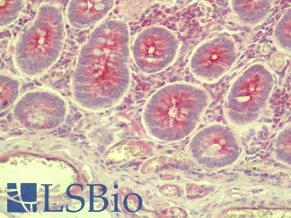 IHC-plus™ SLC35D3 / FRCL1 Antibody