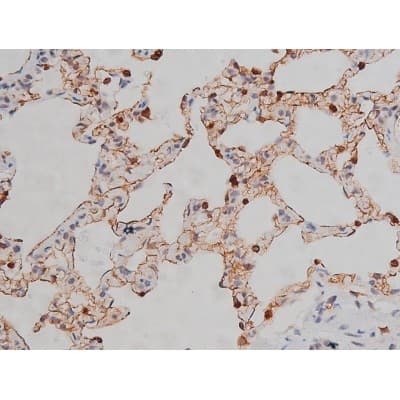 Polyclonal Rabbit anti-Human LYN Antibody (phospho-Tyr508, IHC, IF, WB)