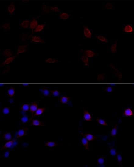 FLNA / Filamin A Antibody