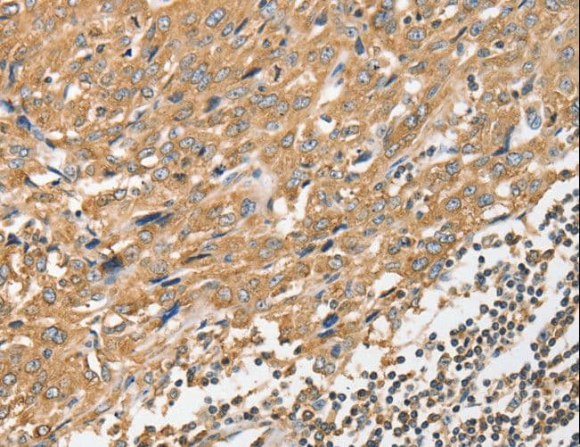 ANGPTL7 / CDT6 Antibody
