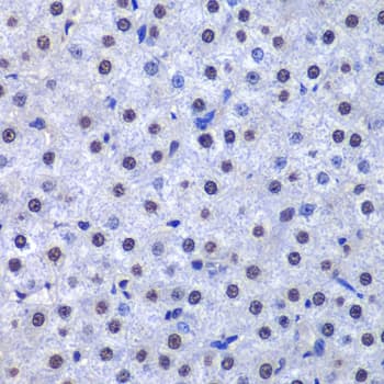 Polyclonal Rabbit anti-Human GSTP1 / GST Pi Antibody (IHC, IF, WB)