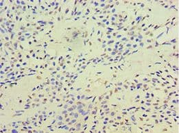 Polyclonal Rabbit anti-Human TERF2IP / RAP1 Antibody (aa1-280, IHC)