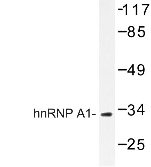 Polyclonal Rabbit anti-Human HNRPA1 / HnRNP A1 Antibody (Glu85, IHC, IF, WB)