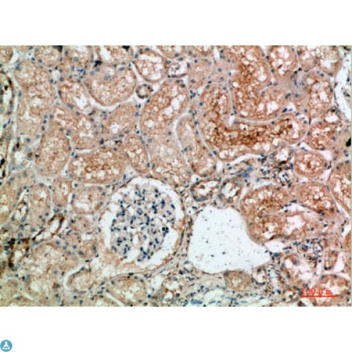 TLE1 / TLE 1 Antibody