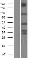 ZFYVE27 / Protrudin Protein (Over-Expression Lysate Myc-DDK (Flag))