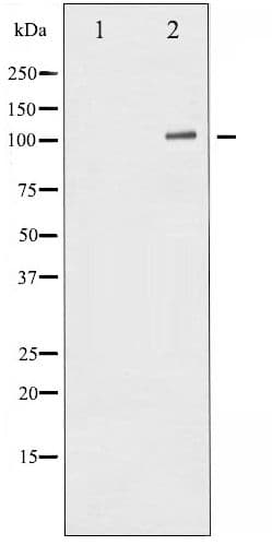 NFKB1 / NF-Kappa-B Antibody (phospho-Ser932)