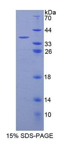 Rat AANAT Protein (Recombinant His-T7)