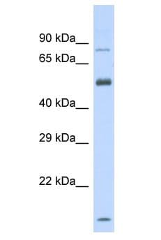 SLC44A4 Antibody (aa351-400)
