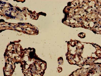 Polyclonal Rabbit anti-Human RHOA Antibody (IHC)