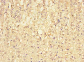Polyclonal Rabbit anti-Human SIGIRR Antibody (IHC, WB)