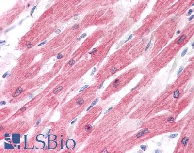 IHC-plus™ MYBPC3 / MYBP-C Antibody (aa1-328)