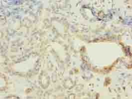 FBXO28 Antibody