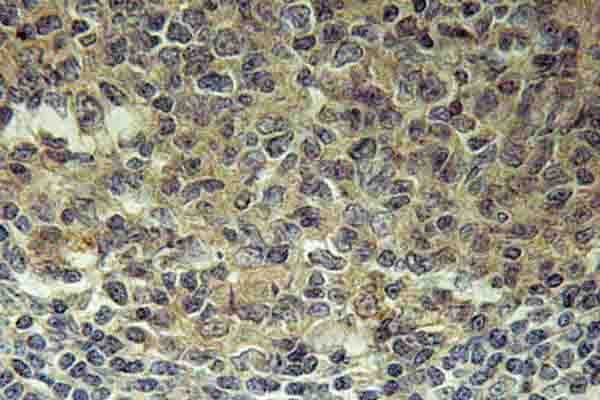 Polyclonal Rabbit anti-Human BLNK Antibody (Asn91, IHC, WB)