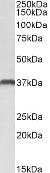 CLEC12A / CD371 Antibody (C Terminus)