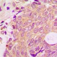 ARRB1 / Beta Arrestin 1 Antibody (C-Terminus)