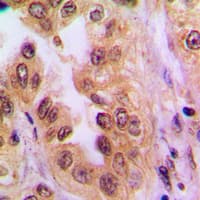RELA / NFKB p65 Antibody (Acetyl-Lys310)