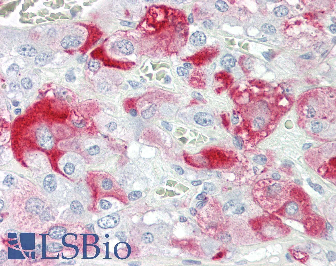 IHC-plus™ SHC3 / SHCC Antibody (aa291-340)