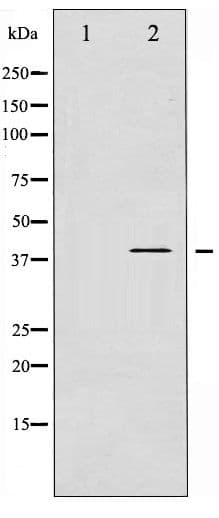 ADRB2 Antibody (phospho-Ser346)