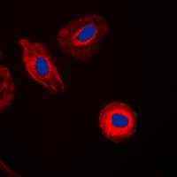 LGALS8 / Galectin 8 Antibody (Internal)