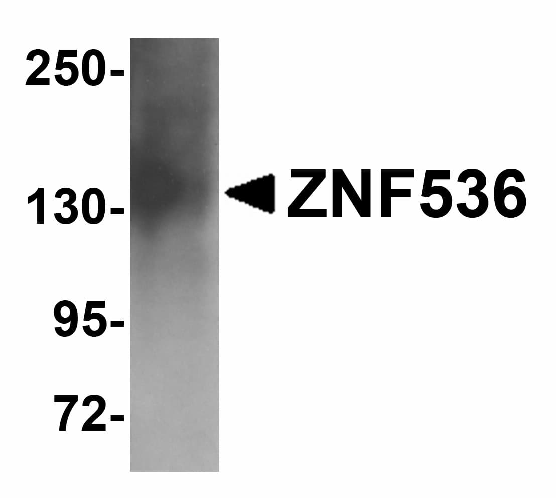 IHC-plus™ ZNF536 Antibody