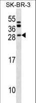 BCL7C Antibody (aa8-34)