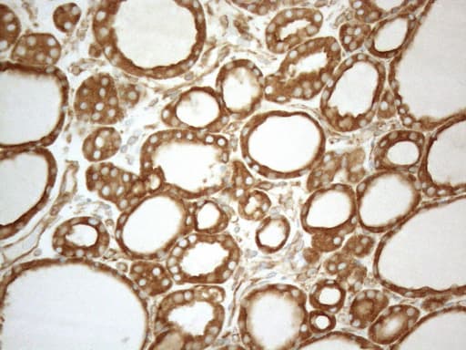 VAP33 / VAPA Antibody (aa2-227, clone OTI10E10)