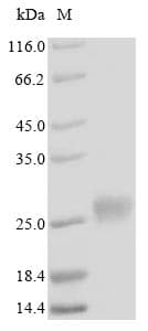 Human MT4 Protein (Recombinant 6His-SUMO, N-terminus)