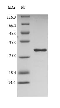 Dermatophagoides pteronyssinus DERP2 Protein (Recombinant 6His-SUMO, N-terminus)