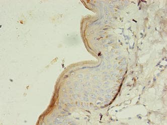 Polyclonal Rabbit anti-Human GK3 / Glycerol Kinase 3 Antibody (IHC, WB)
