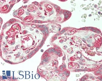 IHC-plus™ Polyclonal Rabbit anti-Human FBLN5 / Fibulin 5 Antibody (IHC, WB)