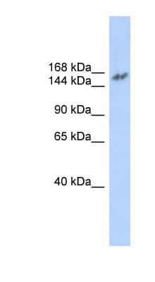 NCOA3 / SRC-3 / AIB1 Antibody (aa71-120)