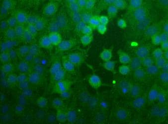 CCR2 Antibody (aa20-100, DY650)
