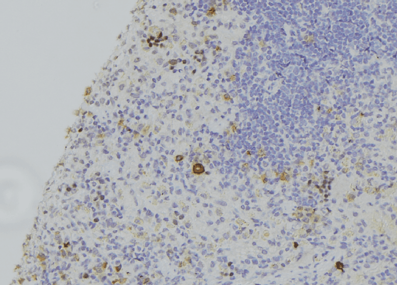 Gasdermin D / GSDMD Antibody