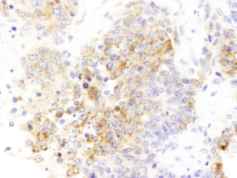DBN1 / Drebrin Antibody (aa599-649)