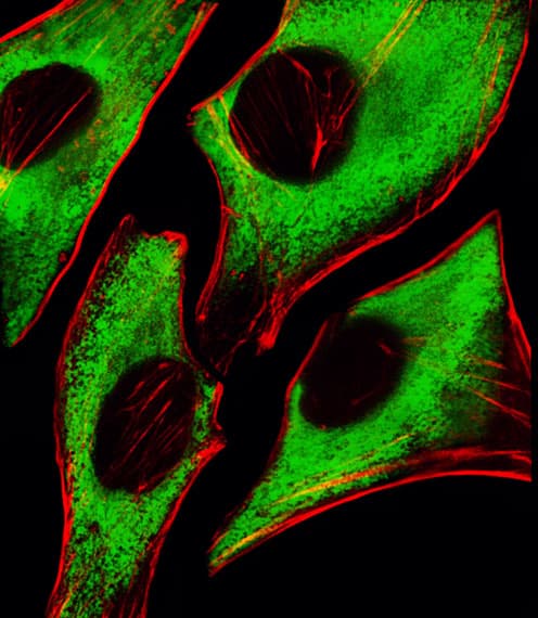 Monoclonal Mouse anti-Human RPS6 / Ribosomal Protein S6 Antibody (clone 981CT2.1.1, N-Terminus, IHC, IF, WB)