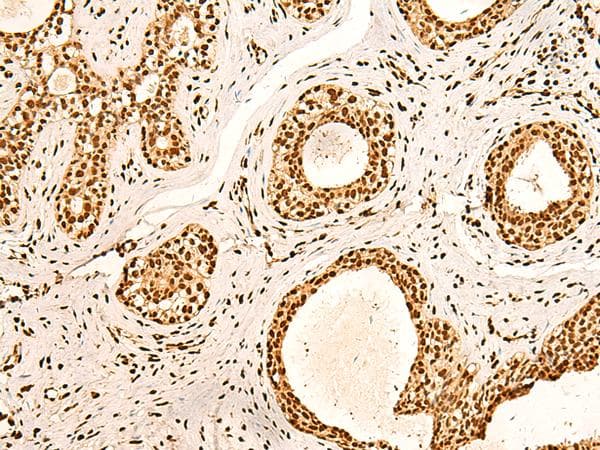Polyclonal Rabbit anti-Human NF90 / ILF3 Antibody (IHC)
