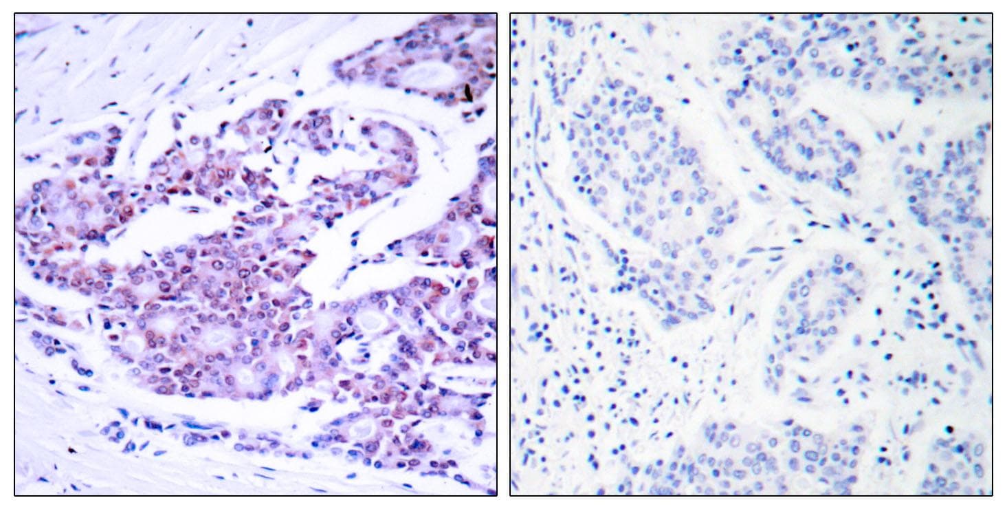 Polyclonal Rabbit anti-Human RELA / NFKB p65 Antibody (p468, IHC, WB)