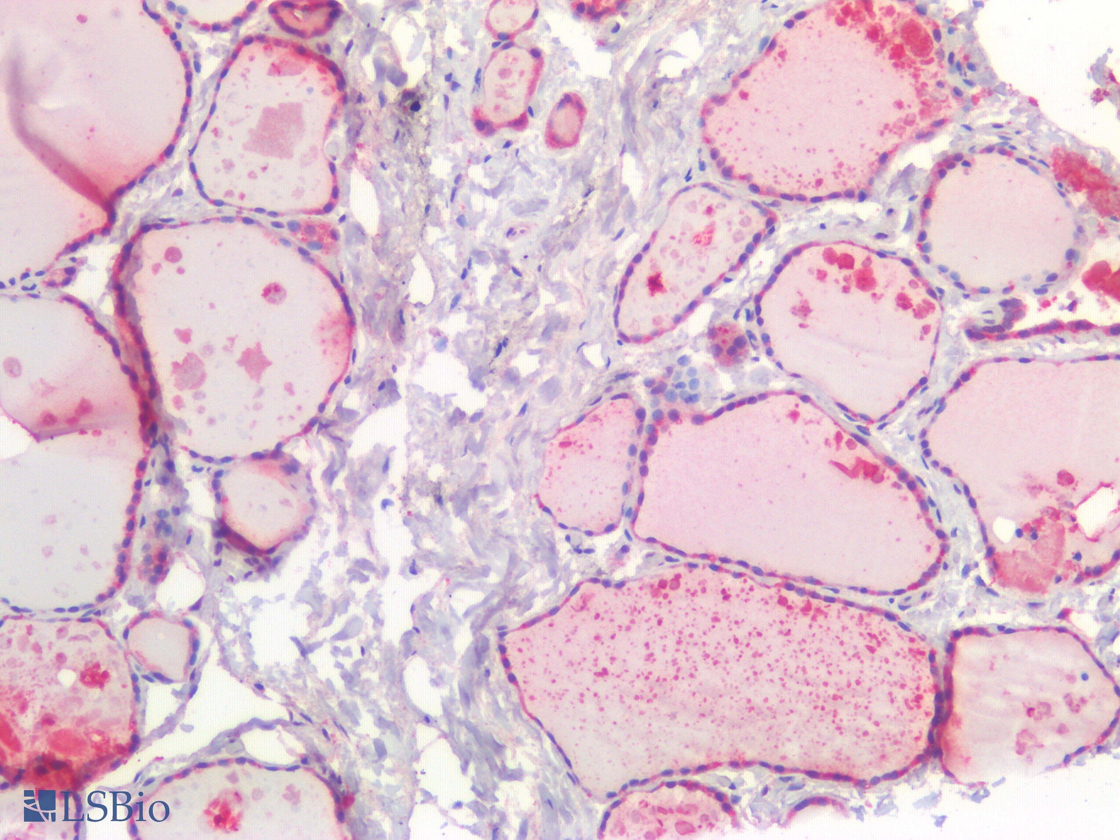 PathPlus™ Polyclonal Rabbit anti-Human TIAM1 Antibody (IHC)