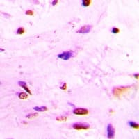 OGG1 Antibody